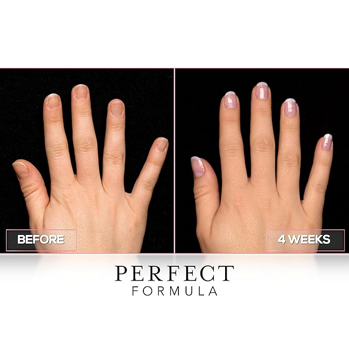 Perfect Formula Clear Gel Coat - Nail Strengthener, Keratin Treatment, Clear Nail Polish - Strengthener for Damaged Nails - Made In The USA .60 fl oz.