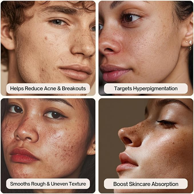 Aura Body Clean Pro⁺ - Silicone Electric Body Scrubber for Acne, Ingrown Hair & KP - IPX7 Waterproof, Rechargeable Exfoliating Shower Brush with Handle. Freeform Grip, & 7000+ Sonic Vibration - Cherry