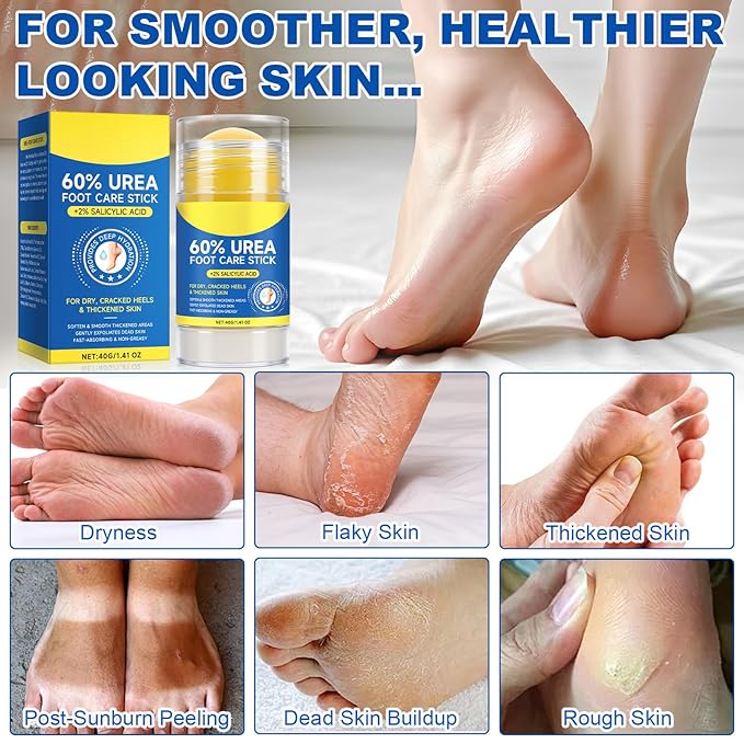 Urea Cream 60 Percent for Feet, 2% Salicylic Acid Urea Foot Cream for Cracked Heels and Dry Skin, Deep Moisturizing, Cracked Heel Repair Cream, Repairing Creams for Heels, Knees, Elbows & Hands (1)