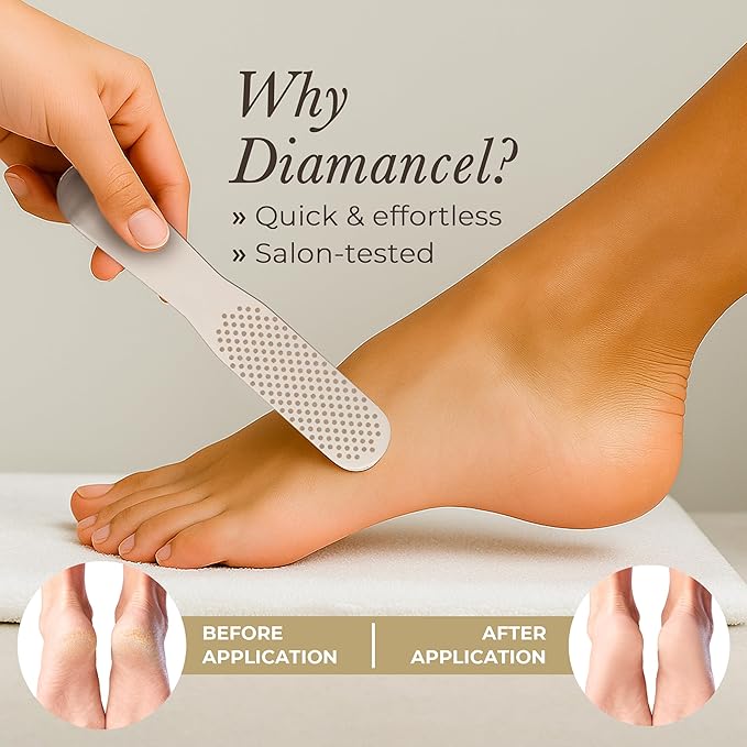 Diamancel Luxury Diamond Foot Buffer - Coarse Grit – For Large Calluses & Rough Skin - #20 (no handle)