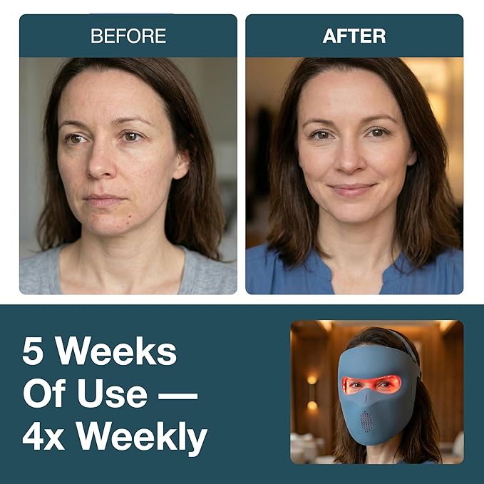 myhalos® Red Light Therapy Face Mask - Medical-Grade LED Light Therapy Device with Nir-Infrared (1072 nm), Red (633 nm) & Blue (460 nm) Light - Anti-Aging Skin Treatment for Wrinkles & Fine Lines