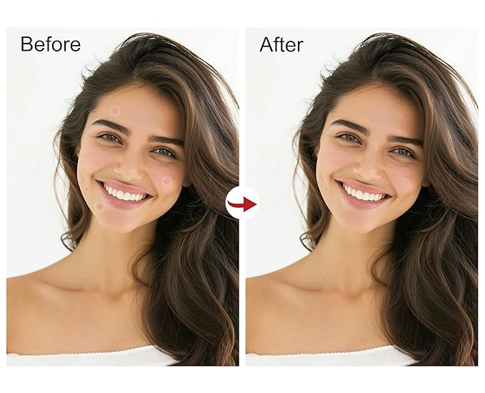 (5¢ Each) Pimple Patches 324 Pack - Hydrocolloid Acne Patches with Salicylic Acid & Tea Tree Oil - 4 Sizes S/M/L/XL - Face Acne Treatment - Easy Peel Perforated Sheets