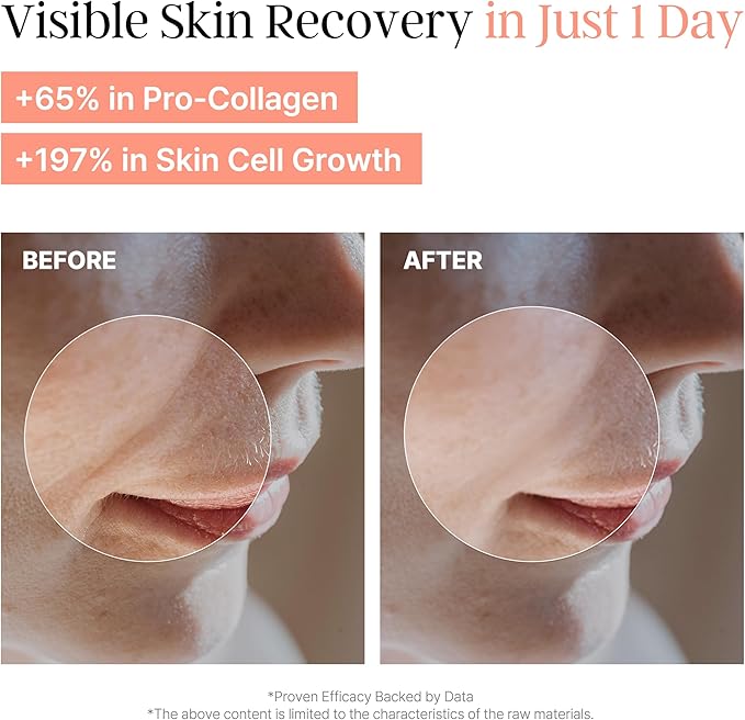 PeachMicrobiome 78 PDRN Toner | Vegan Peach PDRN Skin Barrier Toner | Niacinamide, Panthenol, Allantoin | Barrier Repair, Radiance & Soothing Care, Rebalancing Skin | Korean Skin Care