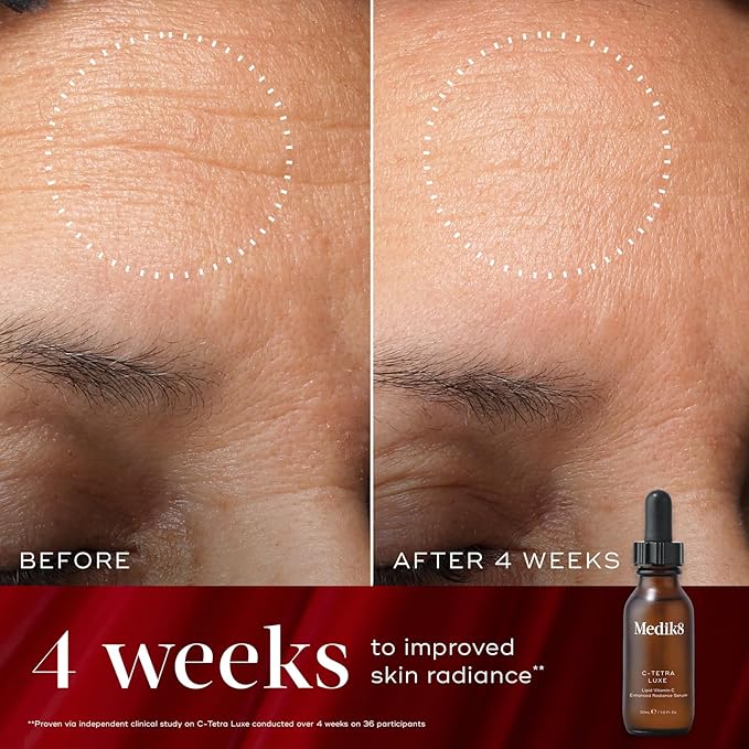 Medik8 Radiance Wrapped Kit - Vitamin C Serum for Face - Facial Cream for Women and Men - Hydrating Peptide Face Moisturizer - 2 pc